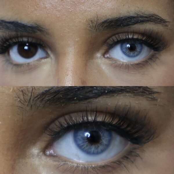 Blaue Kontaktlinse Dubai ICE Blue – Bild 2